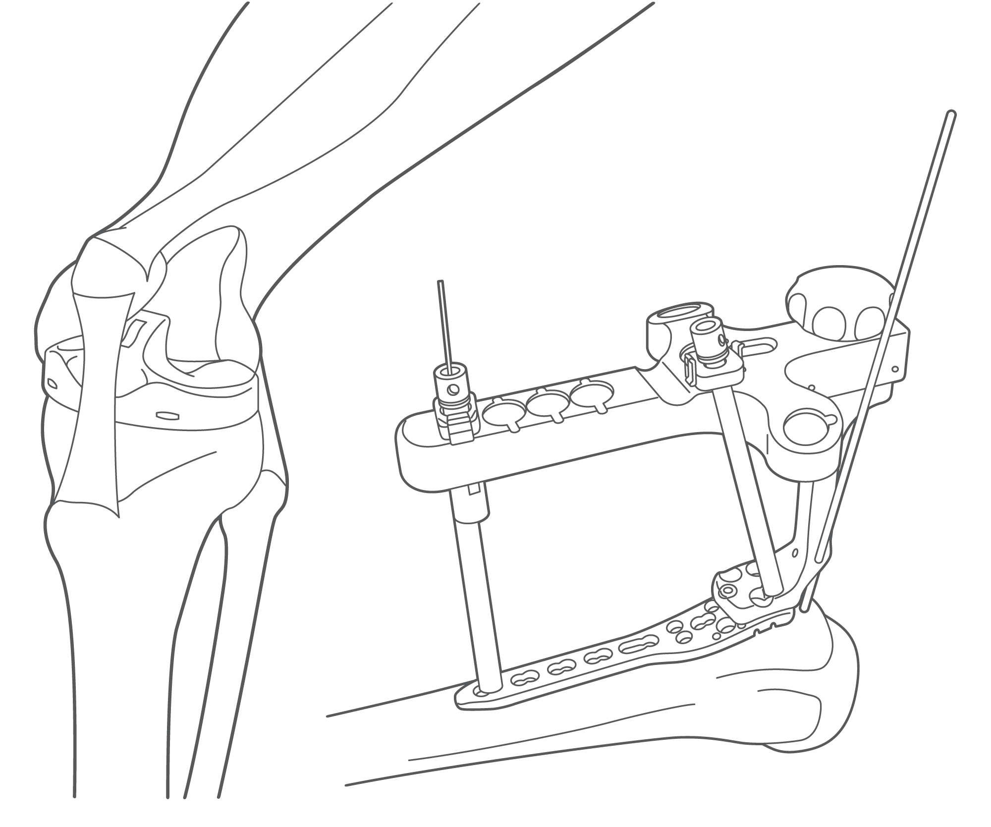 orthopedics-graphic